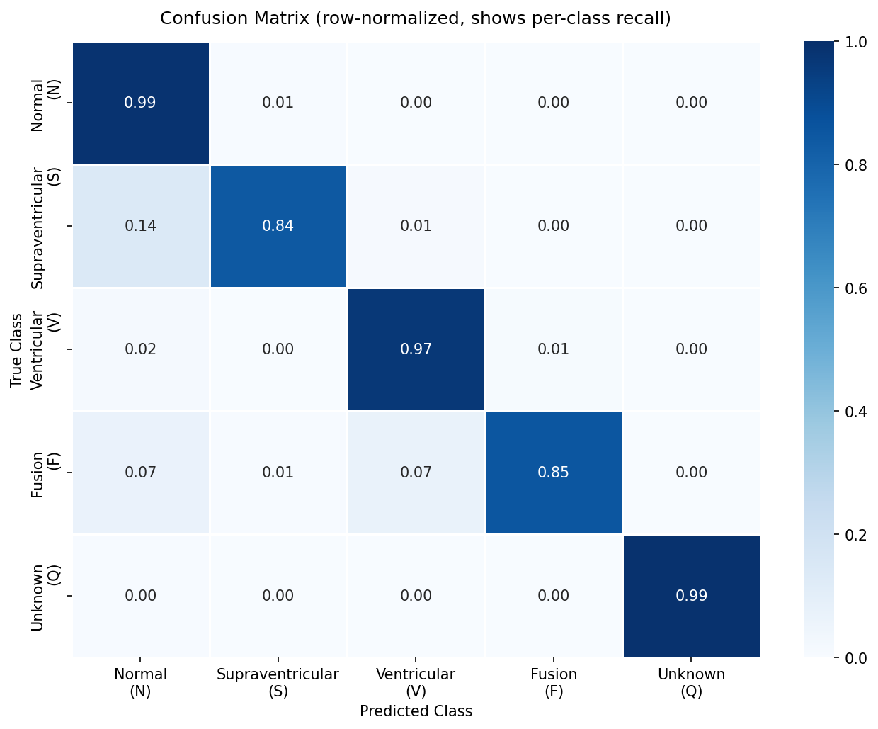 Confusion Matrix