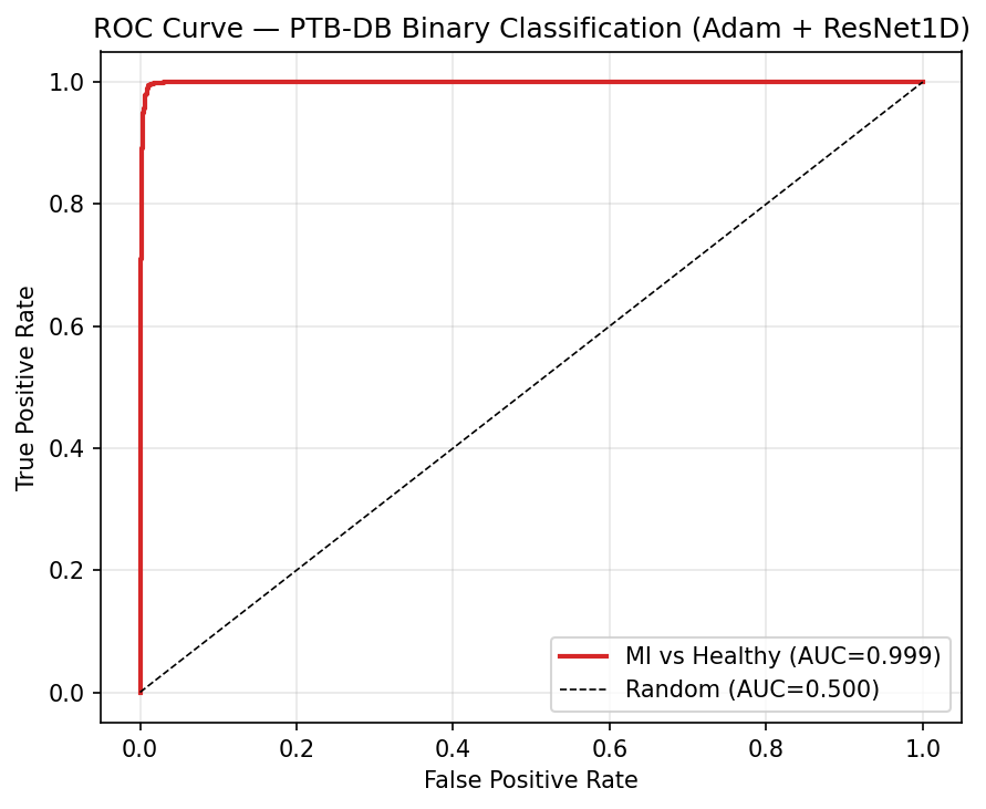 PTB-DB ROC Curve